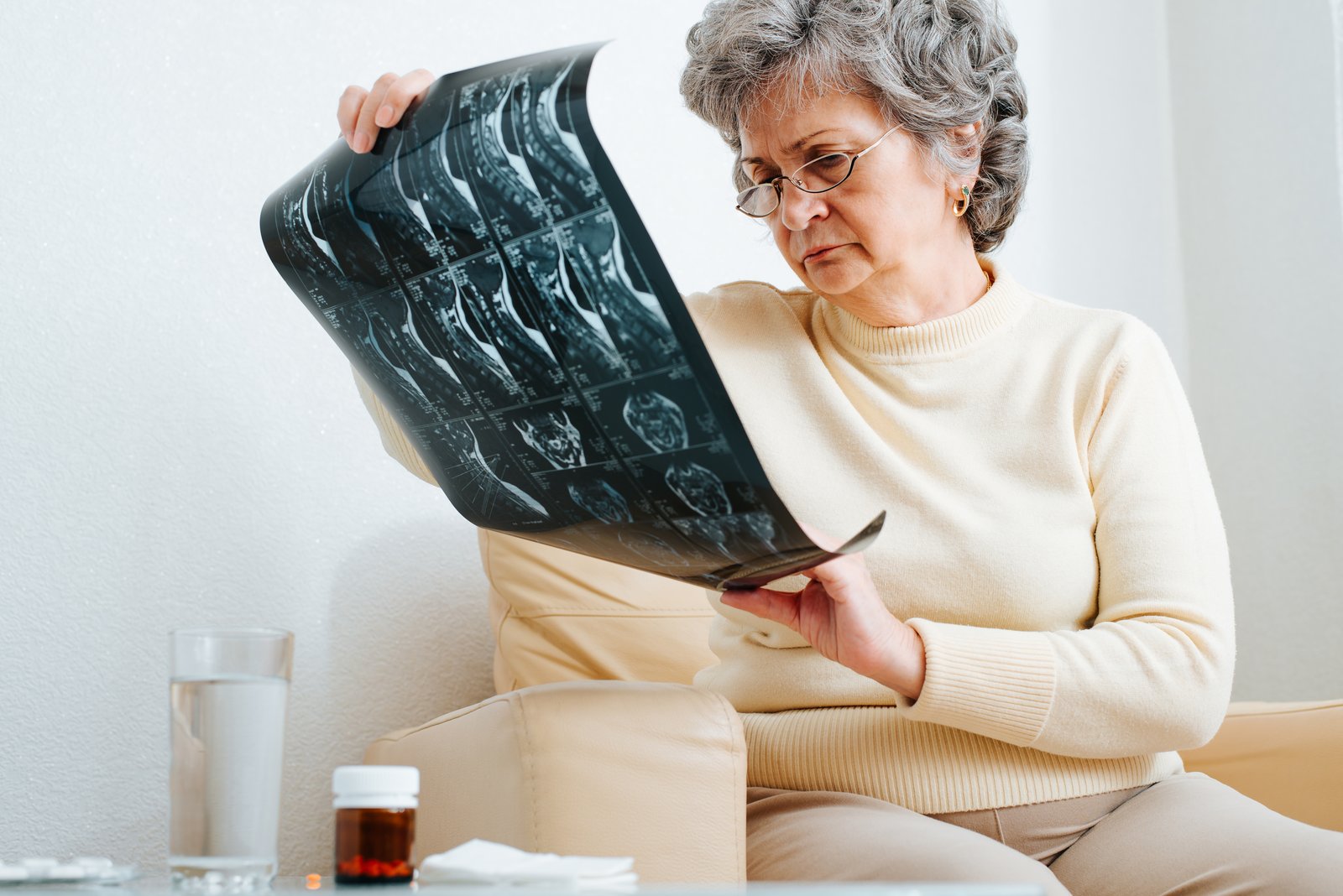 Osteoporoza u menopauzi: zašto kosti slabe i šta se može učiniti