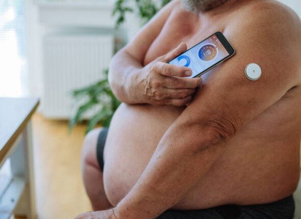 Da li mi je potreban CGM senzor (Libre, Dexcom)?