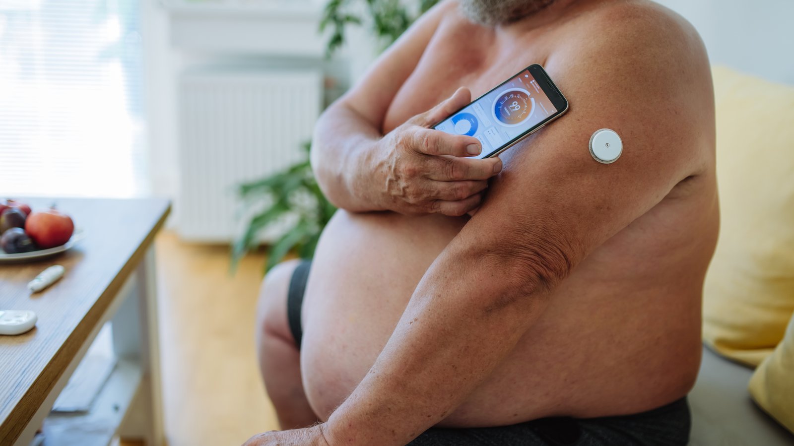 Da li mi je potreban CGM senzor (Libre, Dexcom)?