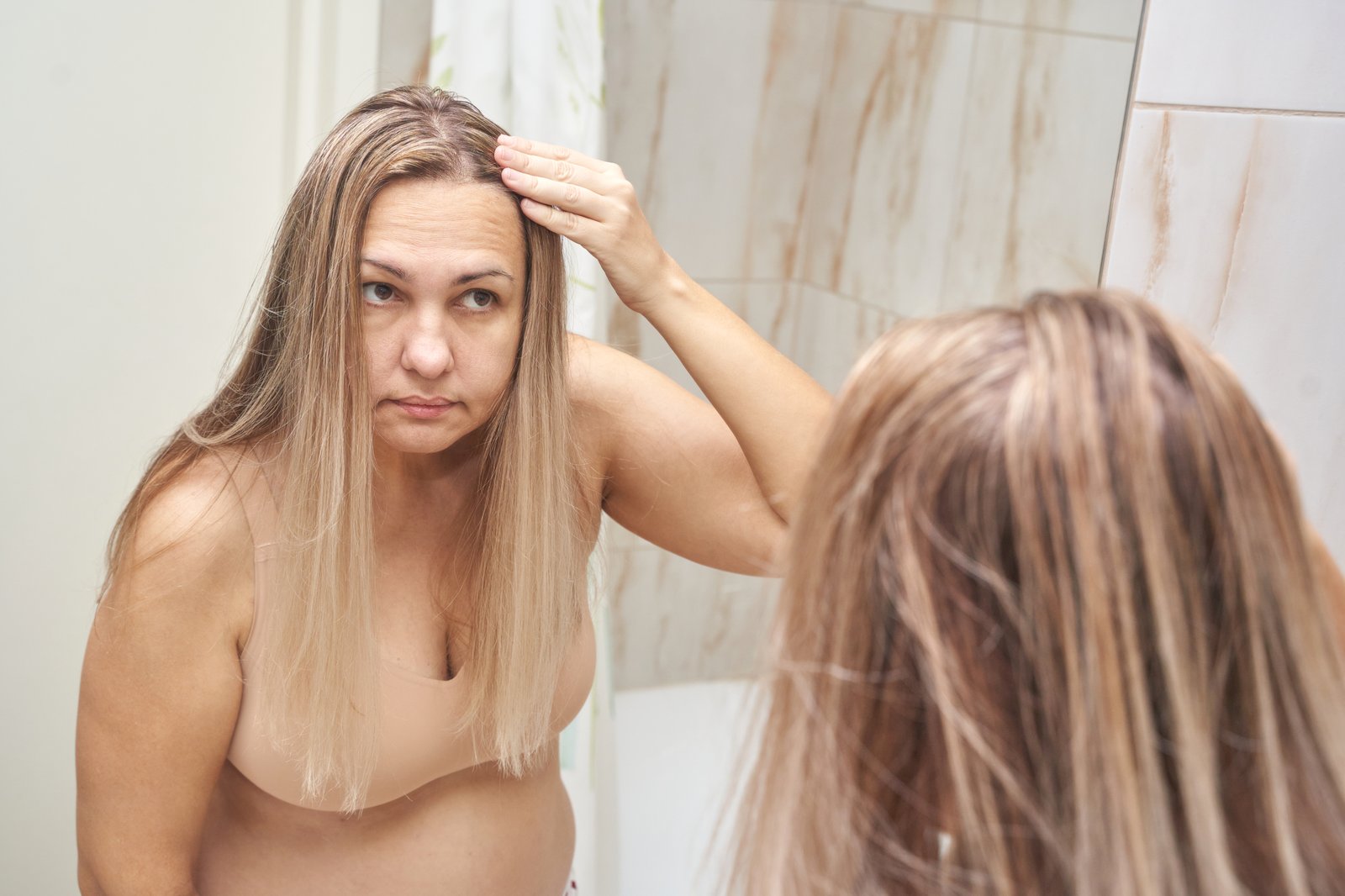 Gubitak kose posle 40: kada je razlog dublji od godina
