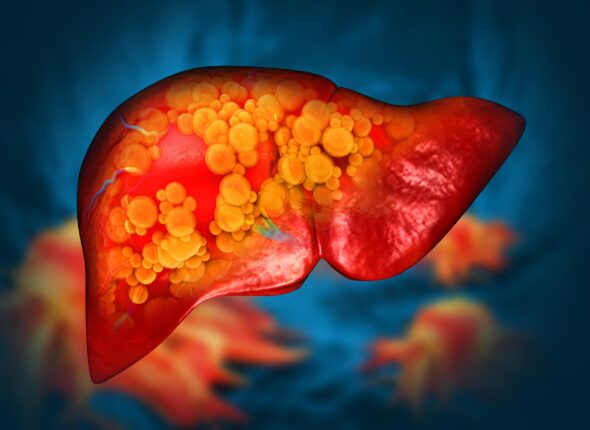 Liver-Damage-Fatty-Fibrosis-Cirrhosis-Cancer-Cells