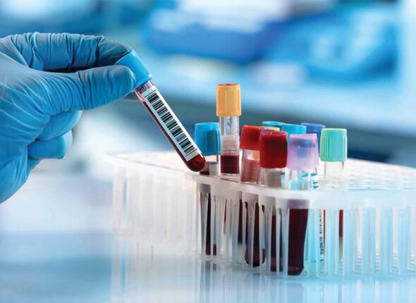 Reasons-to-Get-a-Blood-Test