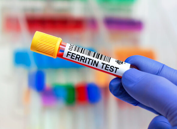 ferritin-nedir-yuksekligi-ve-dusuklugunun-belirtil-7949522